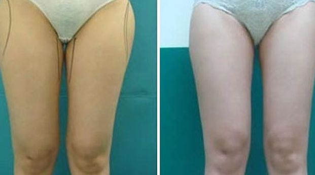 揭陽激光美容醫(yī)院哪家好？選擇揭陽最佳激光美容醫(yī)院的7個(gè)關(guān)鍵要素！