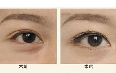寧波隆鼻Top5醫(yī)生：技術精湛，聲譽卓越，口碑贊不絕口！