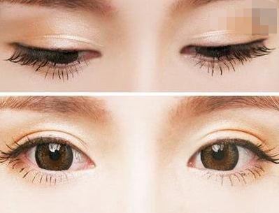 西寧豐胸整形醫(yī)院排名前三，專業(yè)醫(yī)生推薦！