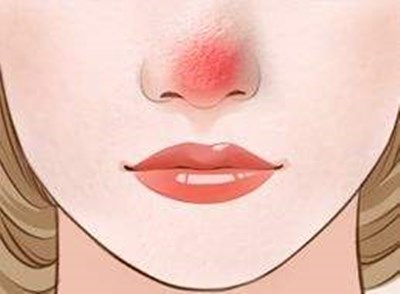 上海九院哪位醫(yī)生做雙眼皮技術(shù)好？價(jià)格如何？附帶成功案例分析