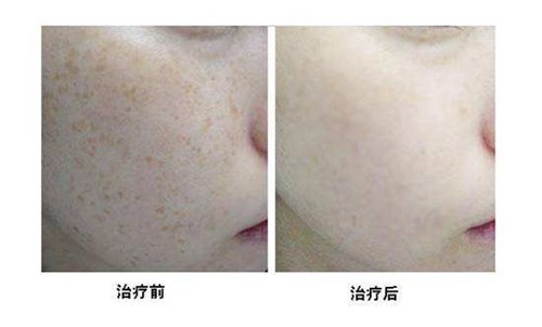 2023西昌專業(yè)腿部吸脂減肥手術(shù)正規(guī)專家口碑前十位(湯穎峰、吳強、劉光毓好評合集推薦)