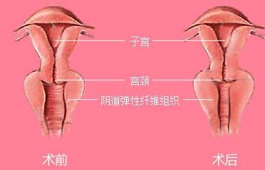 長(zhǎng)沙靠譜矯正醫(yī)院哪家好？解答你所有的疑慮！