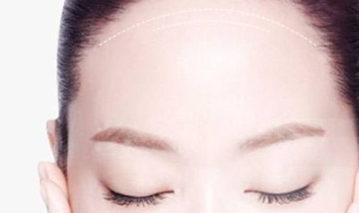 南京做修復(fù)雙眼皮哪家好？解析南京修復(fù)雙眼皮的最佳選擇