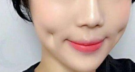 上海超聲刀哪家醫(yī)院做得好？專家推薦，超聲刀手術最佳選擇