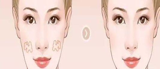 南京哪家醫(yī)院的小陰唇整形效果好？