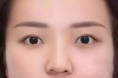 2023長治熱瑪吉祛疤專家推薦前十(田書強(qiáng)、李學(xué)雷、董琦這些醫(yī)生更靠譜，更放心！)