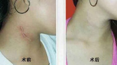 上海中西醫(yī)結(jié)合醫(yī)院整形美容科靠譜嗎？聽說口碑不錯(cuò)！