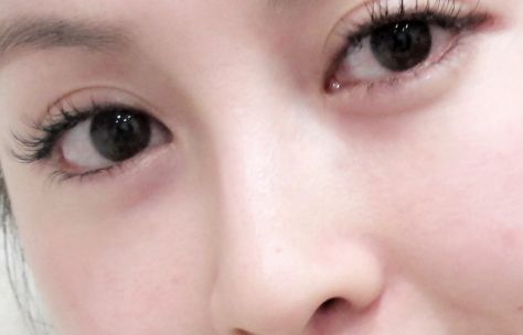 在烏魯木齊有哪些值得推薦的開眼角好醫(yī)院？