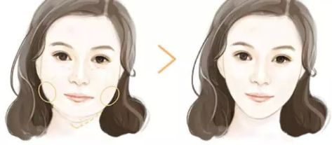 上海哪家下頜骨醫(yī)院好？解析上海下頜骨疾病常見病例及專業(yè)治療！