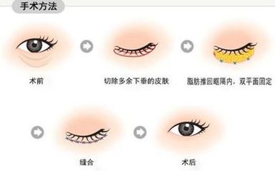 南寧治療痘印哪家醫(yī)院靠譜？—用戶首選南寧去痘印醫(yī)院排行榜