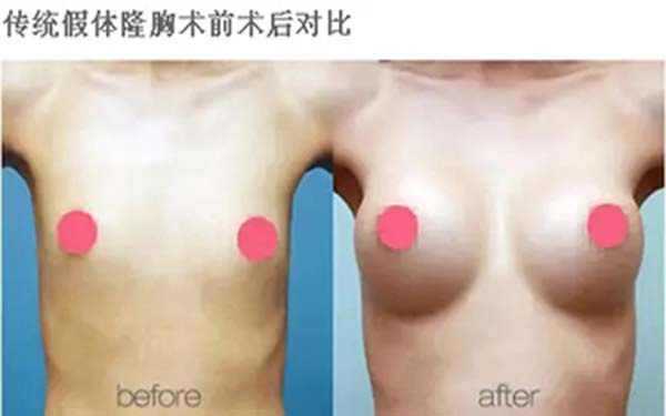 溫州雍禾醫(yī)院信譽(yù)如何？求推薦占家佳醫(yī)生植發(fā)效果如何？或溫州雍禾醫(yī)院口碑怎么樣？哪位醫(yī)生適合占家佳植發(fā)