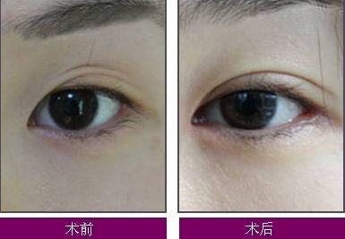 煙臺整疤痕哪家醫(yī)院好？了解煙臺整疤痕醫(yī)院的綜合評價和治療效果