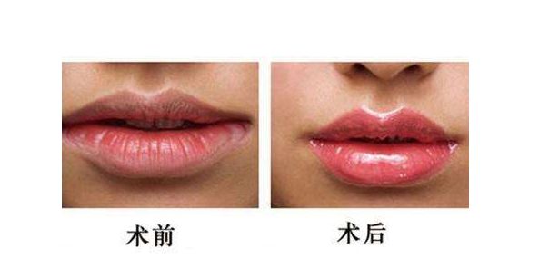 江蘇哪家醫(yī)院做激光祛斑好？