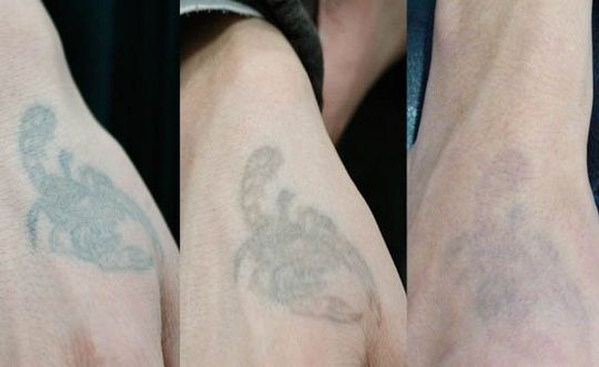 哈爾濱各具實(shí)力的隆鼻專家：宋楠、朱臺(tái)航、吳謙等斬獲排名！