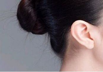 鄭州趙麗做雙眼皮修復(fù)效果如何？整形醫(yī)生背景和坐診情況請看！