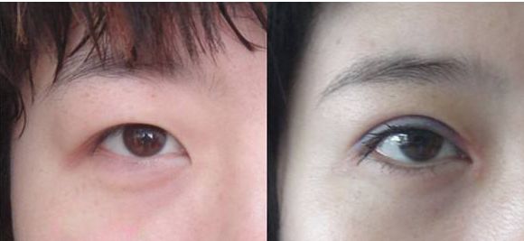 北京豐胸整形醫(yī)院哪家好？綜合評價和患者口碑推薦