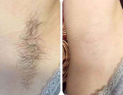 上海整形醫(yī)院哪家的好？最權(quán)威的排名榜單來幫你挑選！