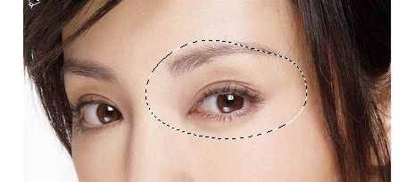 成都米蘭柏羽盧尚兵雙眼皮是否有效？美杜莎美眼術(shù)技術(shù)真如傳說中那么神奇？