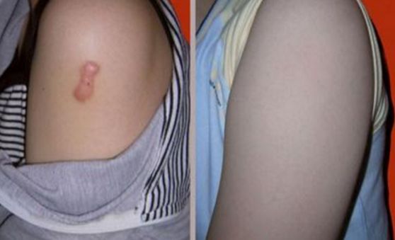 上海雙眼皮切開手術(shù)，哪家醫(yī)院技術(shù)好且安全？