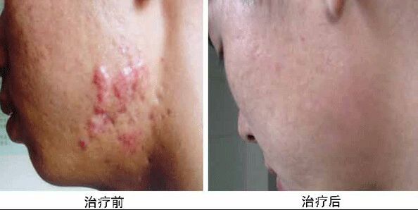 南京哪家醫(yī)院做兔唇手術(shù)效果好又安全？