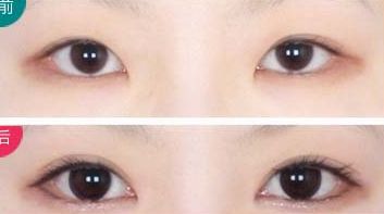 西安治療瘢痕哪家醫(yī)院好評(píng)不斷！