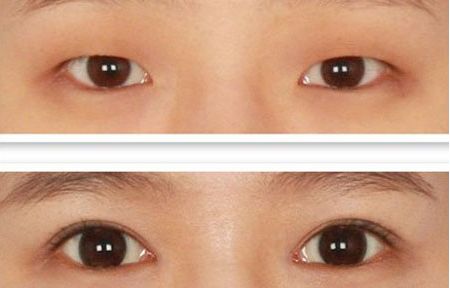 北京整容科好的醫(yī)院有哪些？中關(guān)村整形醫(yī)院綜合實(shí)力領(lǐng)先！
