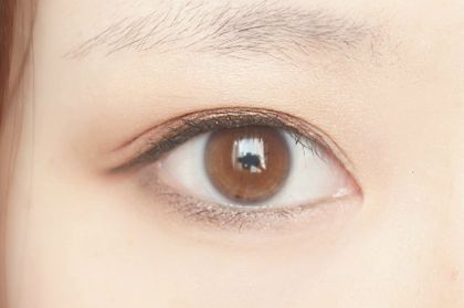 蕪湖伊萊美雙眼皮效果如何？有專家推薦嗎？