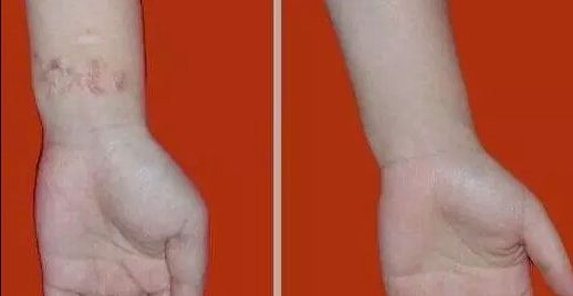 杭州哪家醫(yī)院看喉嚨好？排名最好的專業(yè)醫(yī)院推薦