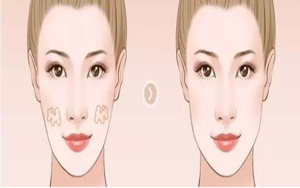 上海雙眼皮埋線醫(yī)院排名及專家推薦：哪家醫(yī)院最好？
