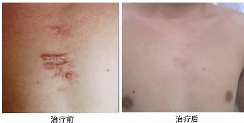 2023洛陽(yáng)去除眼尾紋皺紋正規(guī)醫(yī)生排行前十(單寶奇、王靜、劉淑蘭為您塑造好身材)