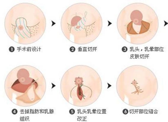 保定的整形醫(yī)院哪家好？全面解析保定整形醫(yī)院排名、口碑、專業(yè)團隊等