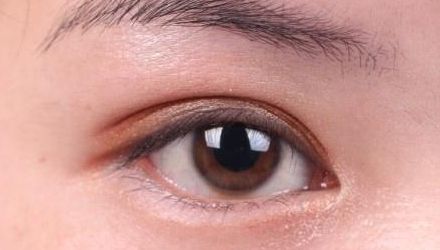 蘇州雙眼皮修復(fù)醫(yī)院排名及口碑，哪家醫(yī)院修復(fù)效果最好？