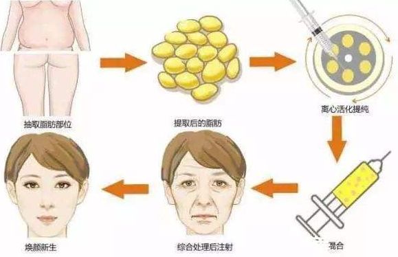 重慶整形磨骨哪家醫(yī)院好？整形醫(yī)院排行榜解讀，選擇最適合您的醫(yī)院！
