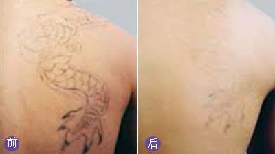 無錫哪家醫(yī)院眼科專業(yè)好？