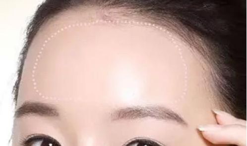 常州治療脫發(fā)哪家醫(yī)院靠譜？
