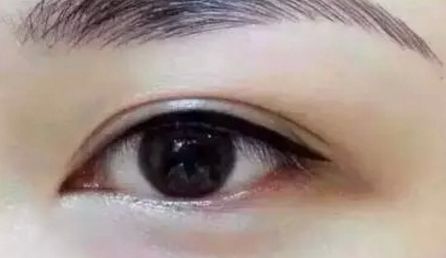 做鼻子還是做胸部手術(shù)？李高峰美萊醫(yī)師的技術(shù)值得信賴嗎？價格合理嗎？