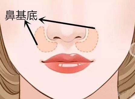 北京大學(xué)深圳醫(yī)院雙眼皮手術(shù)，何君君醫(yī)生口碑如何？資料公開！
