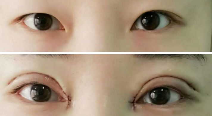 貴陽哪家醫(yī)院熱瑪吉效果好，值得推薦？