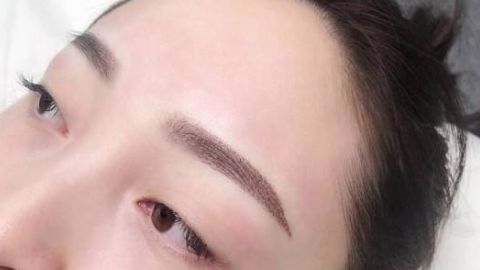 田國靜的眼袋修復(fù)價格如何？有推薦的醫(yī)生嗎？