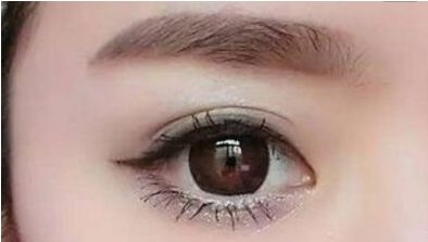 長沙哪位醫(yī)生擅長解燦割雙眼皮技術？