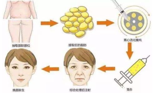 鄭州鼻整形哪家醫(yī)院好？一篇權(quán)威評(píng)測(cè)解答你的疑惑！
