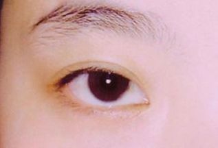 西安看胎記醫(yī)院哪家好？選擇胎記專科醫(yī)院，專業(yè)技術(shù)得到用戶好評(píng)！