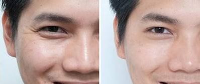 南京哪家整形醫(yī)院隆鼻效果最好？