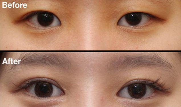 昆明刀疤修復(fù)哪家醫(yī)院好？挑選昆明專業(yè)刀疤修復(fù)醫(yī)院的技巧與要點(diǎn)