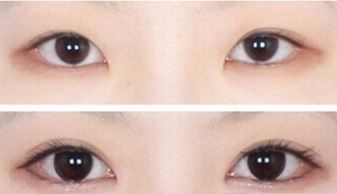 濟(jì)南哪家醫(yī)院的豐胸手術(shù)效果最好？