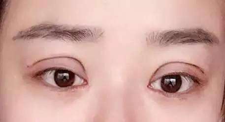 2023廣州乳房下垂上提口碑醫(yī)生(馮雪貞、王鋒、盧仕良既權(quán)威技術(shù)又先進(jìn))