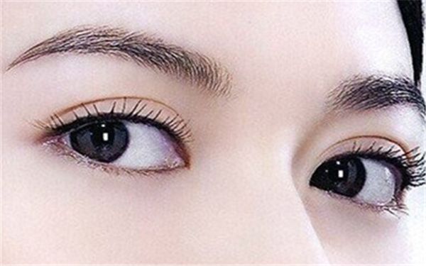 如何選擇北京雙眼皮埋線哪家好？細(xì)致評(píng)級(jí)幫您快速?zèng)Q策！