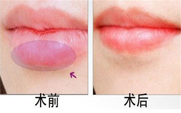 2023常德平滑吸脂瘦身評(píng)分十強(qiáng)醫(yī)生(陳勇、肖世錦、李進(jìn)進(jìn)這些專家口碑靠前)