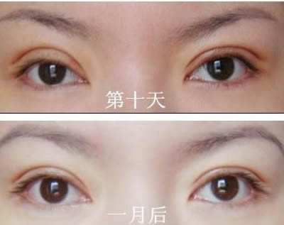 2023金華大拉皮去皺紋醫(yī)生上榜清單前10位(樸光哲、張小兵、李志金口碑技術(shù)雙加持！)