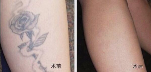 不二選擇！上海鼻修復(fù)專家徐永豐、劉仁輝搶占熱門名單成功！個(gè)人實(shí)力攀升不可阻擋！